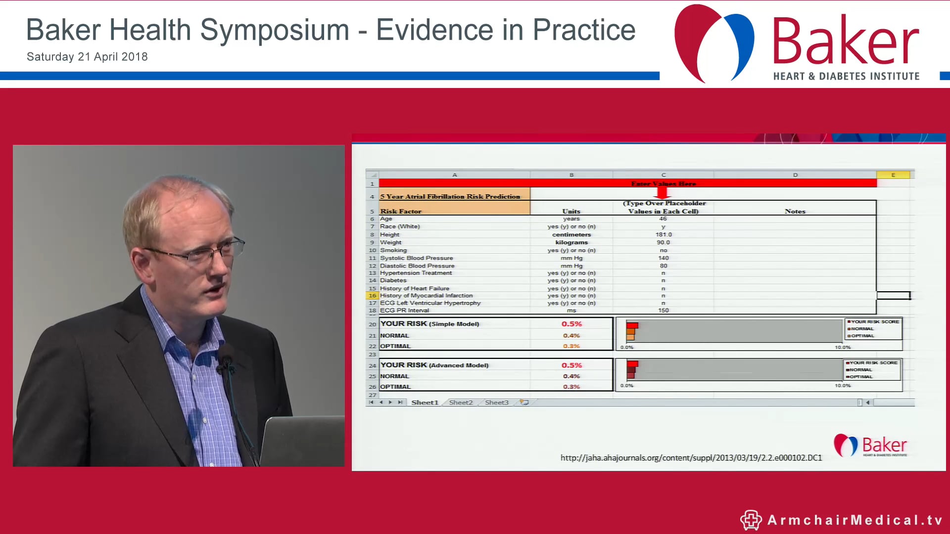 AF management and how to implement a process for AF screening Dr Alex McLellan