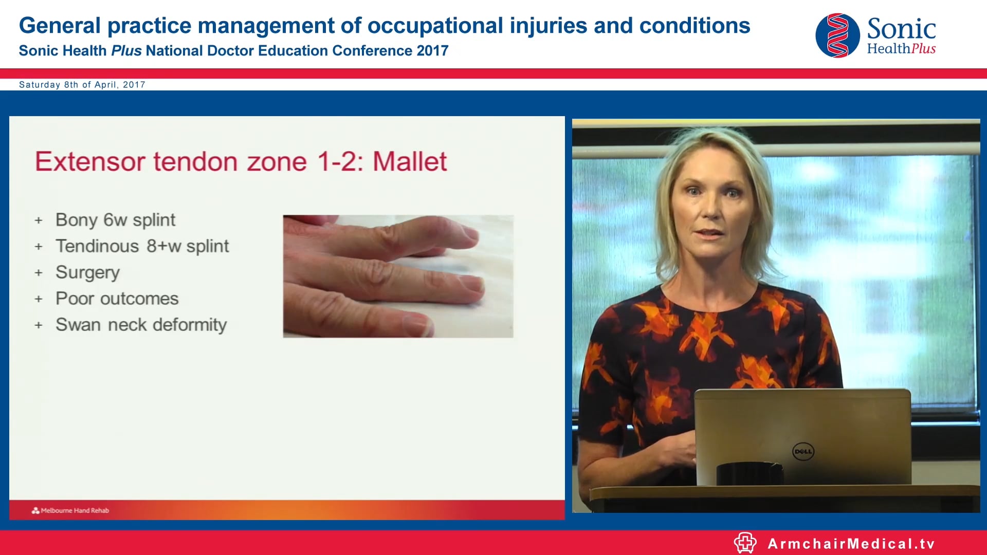 Hand therapy for common hand injuries Karen Fitt