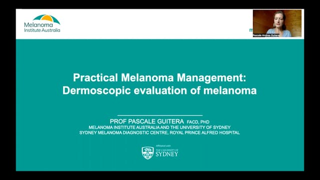 Practical melanoma management Dermosc...