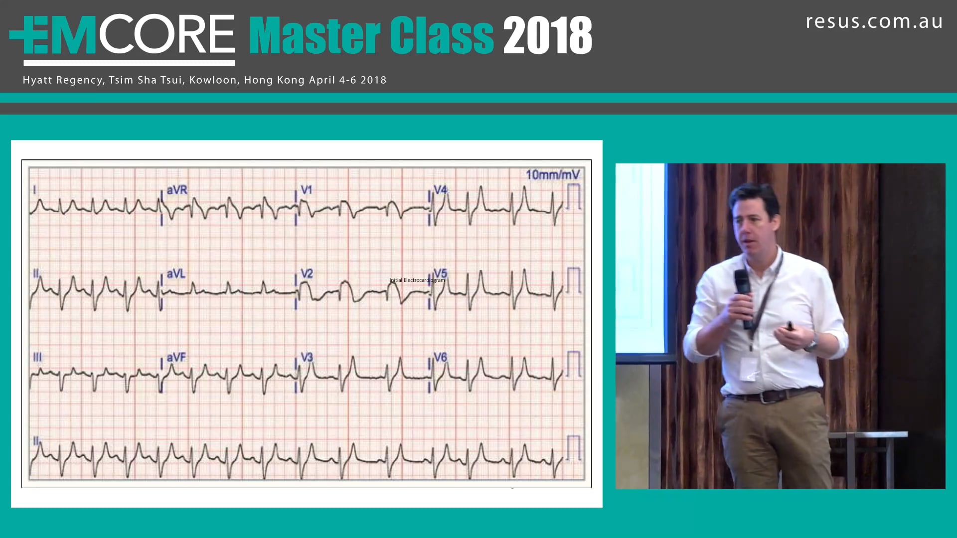 ECG Quiz Kas, Lawton, Davies, Edwards, Wilkin, Michaels