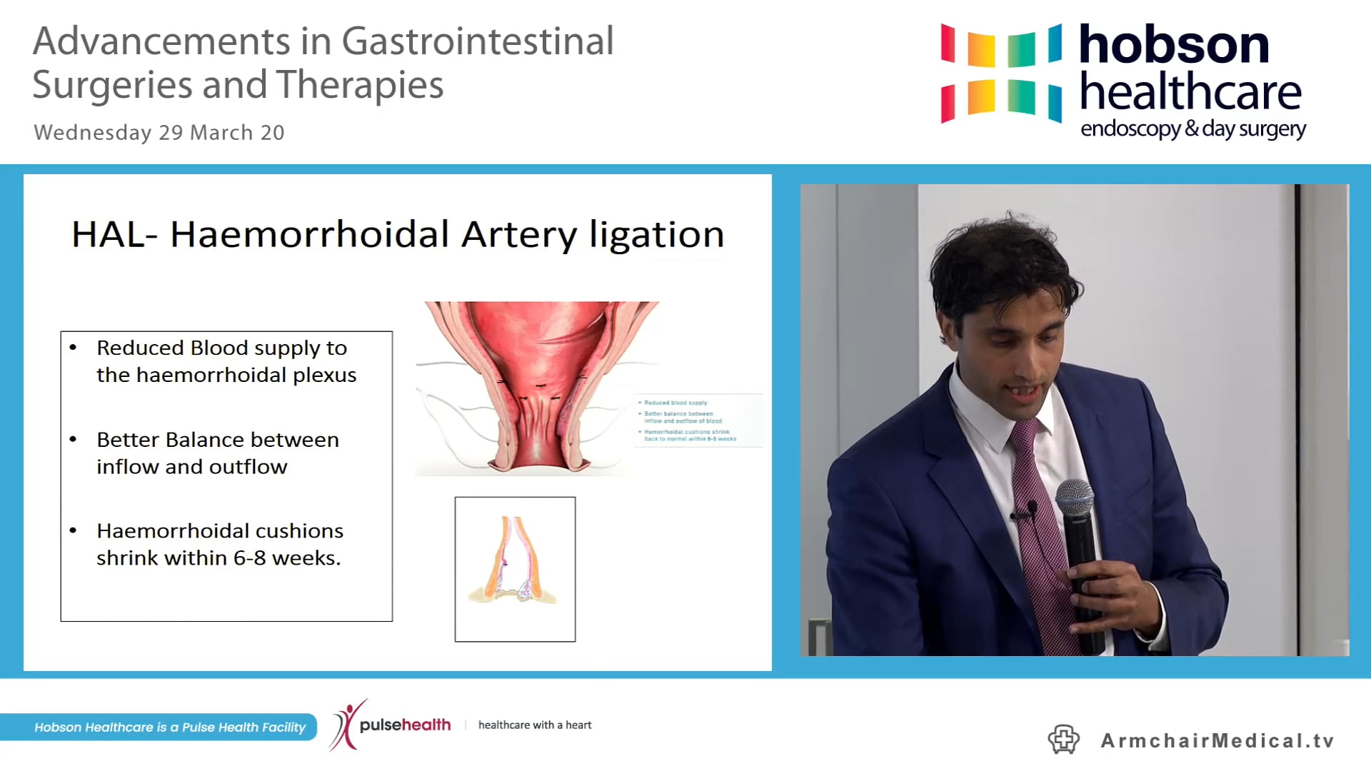 5 Advancements in anorectal treatment and rectal cancer Mr Satish Warrier