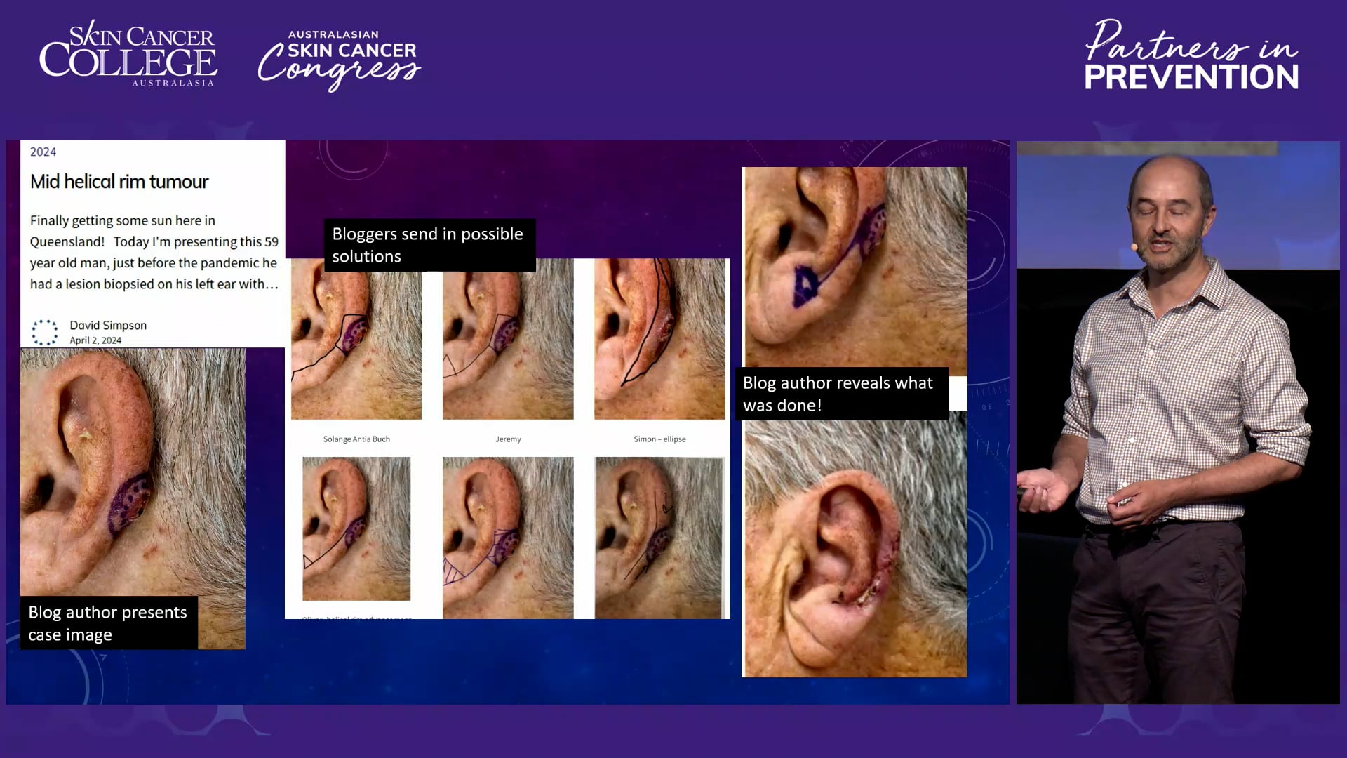 9.3 Pearls from the Blog Simple Skin Surgery Tips Dr David Simpson