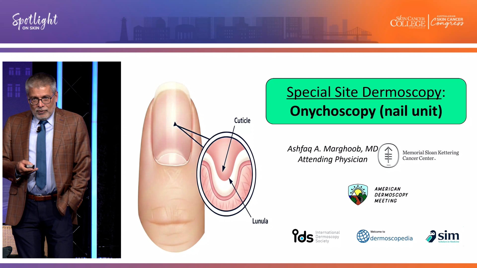 Dermoscopy Masterclass Nail Dr Ashfaq Marghoob