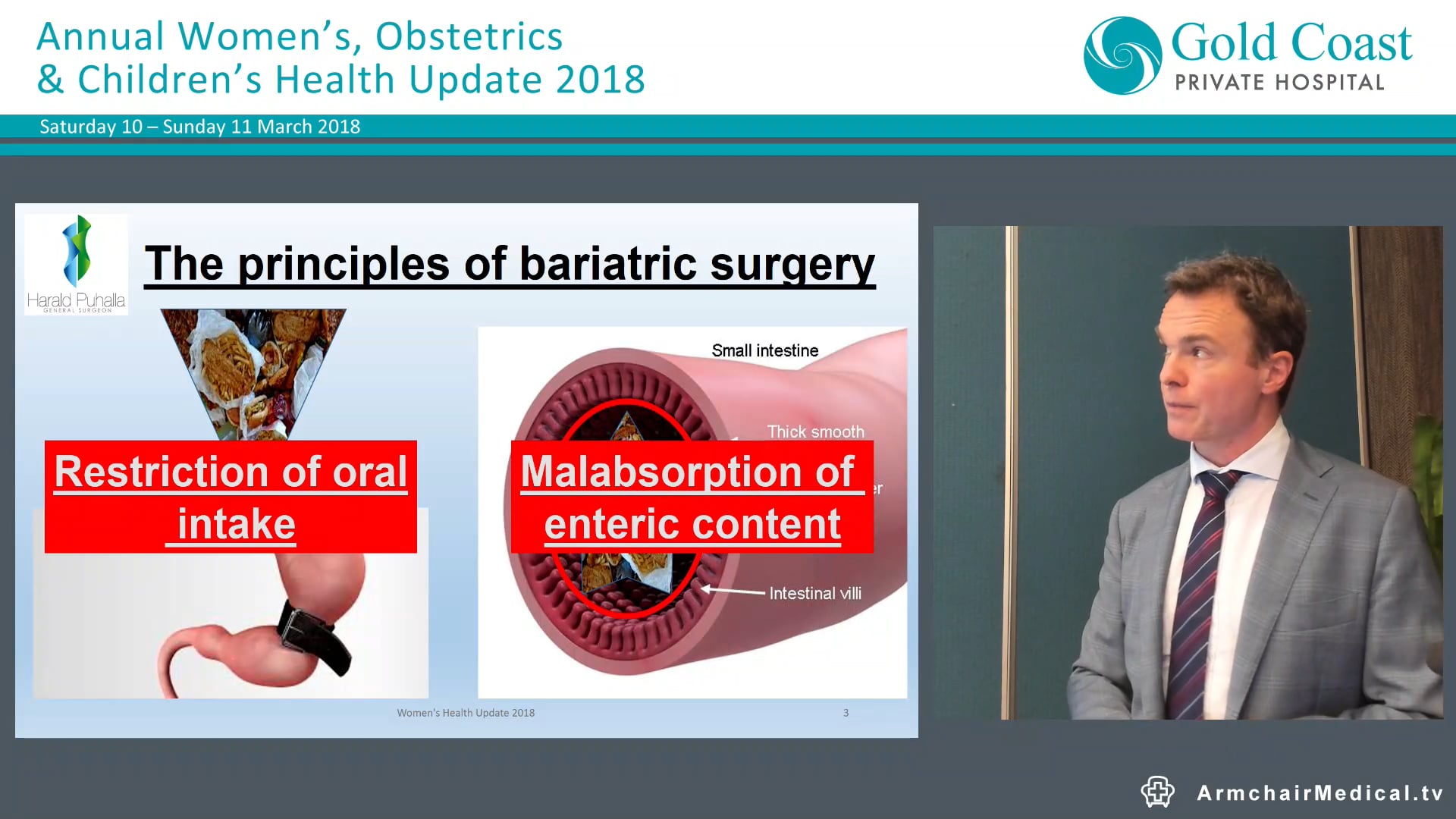 Women after Bariatric Surgery Benefits, Trade-offs, Outcomes Assoc Prof Harald Puhalla, General & Bariatric Surgeon