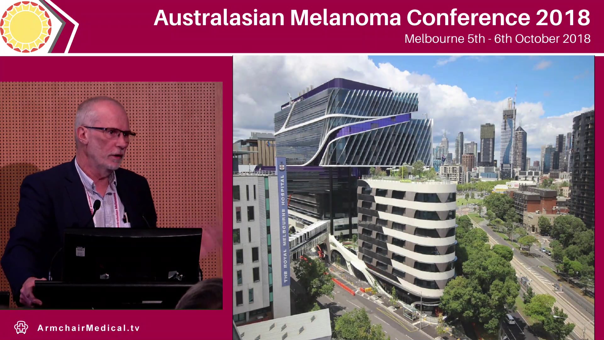 When not to do a sentinel node biopsy Michael Henderson