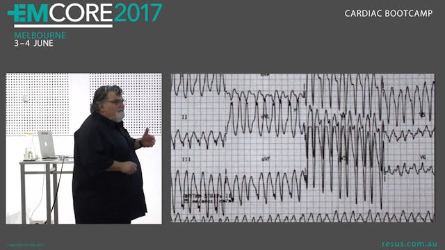 Brugada, Wellens, Dewinters, Spodick,...