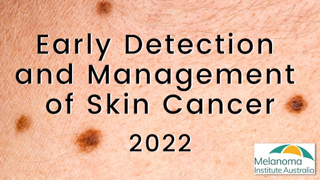 Early Detection of Skin Cancer 2022