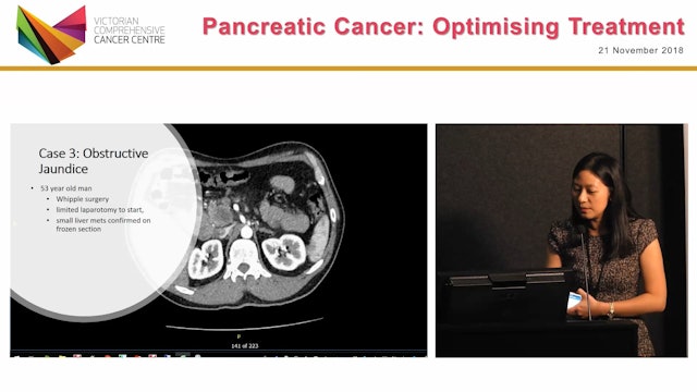 Case 2 First Line in Metastatic Pancreatic Cancer Dr Hui Li Wong