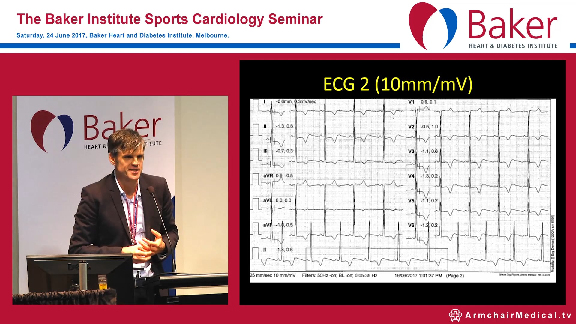 Case: Female marathon runner with chest pain Assoc Prof André La Gerche
