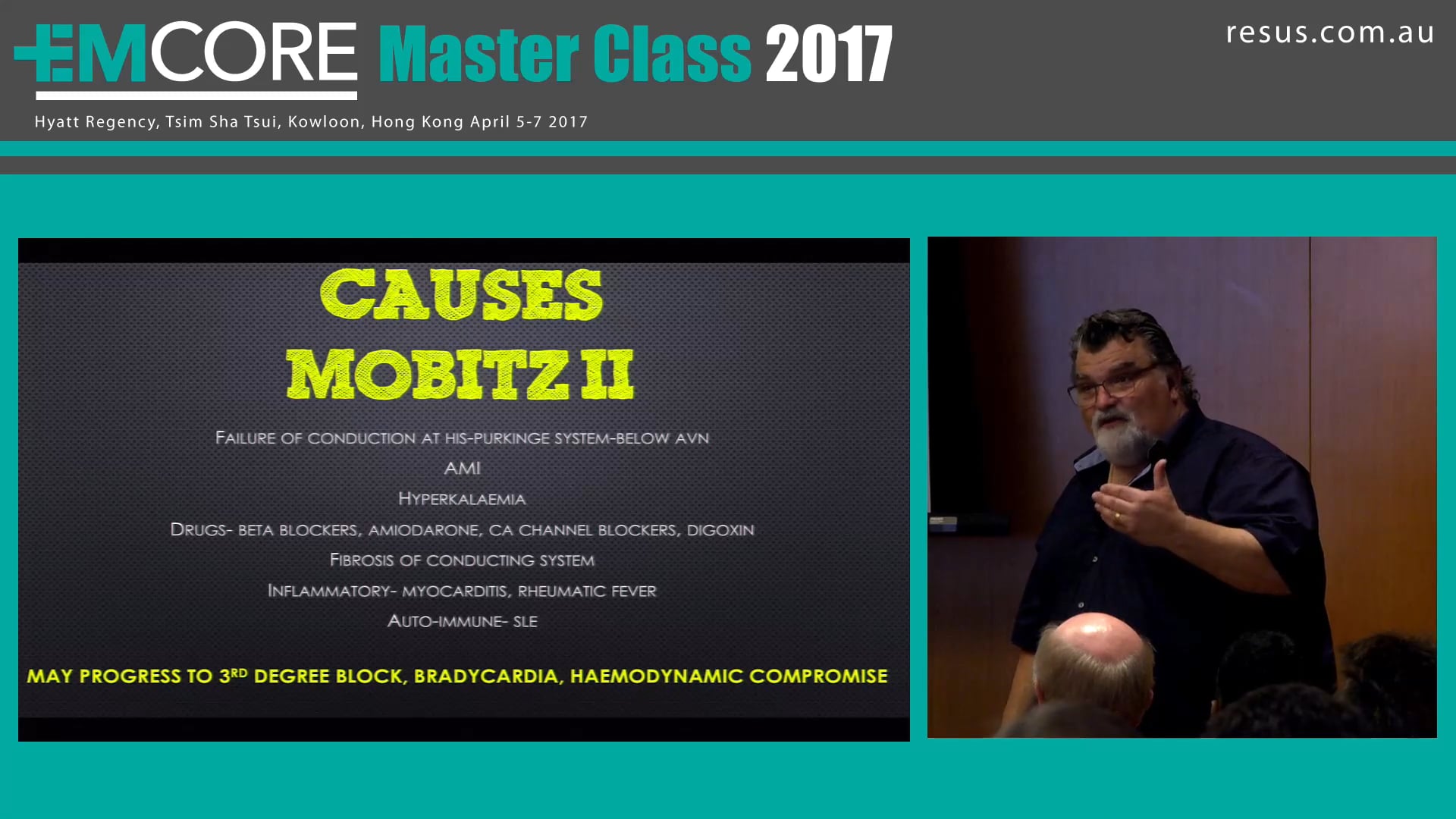 Don't miss the Mobitz Assoc Prof Peter Kas