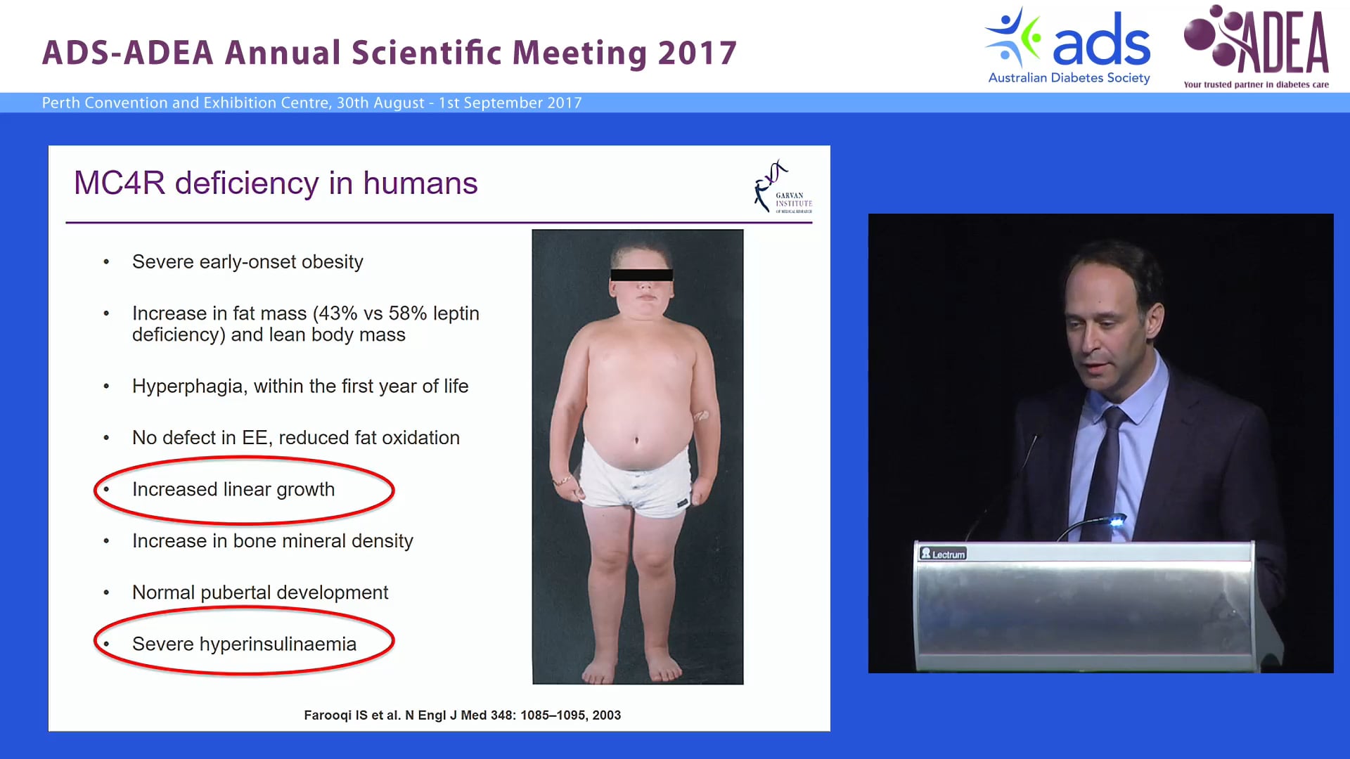 ADS R & A Wikramanayake Award Characteristics of novel sub-phentotypes of human obesity Implications for diabetes prevention and treatment Jerry Greenfield