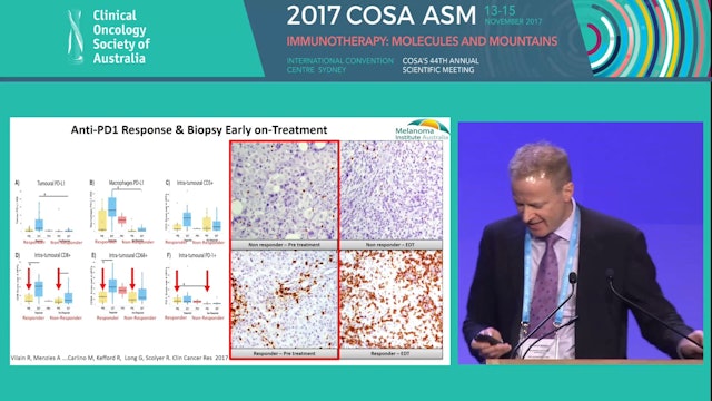 Predictive markers of response and resistance to immunotherapies in melanoma Prof Richard Scolyer