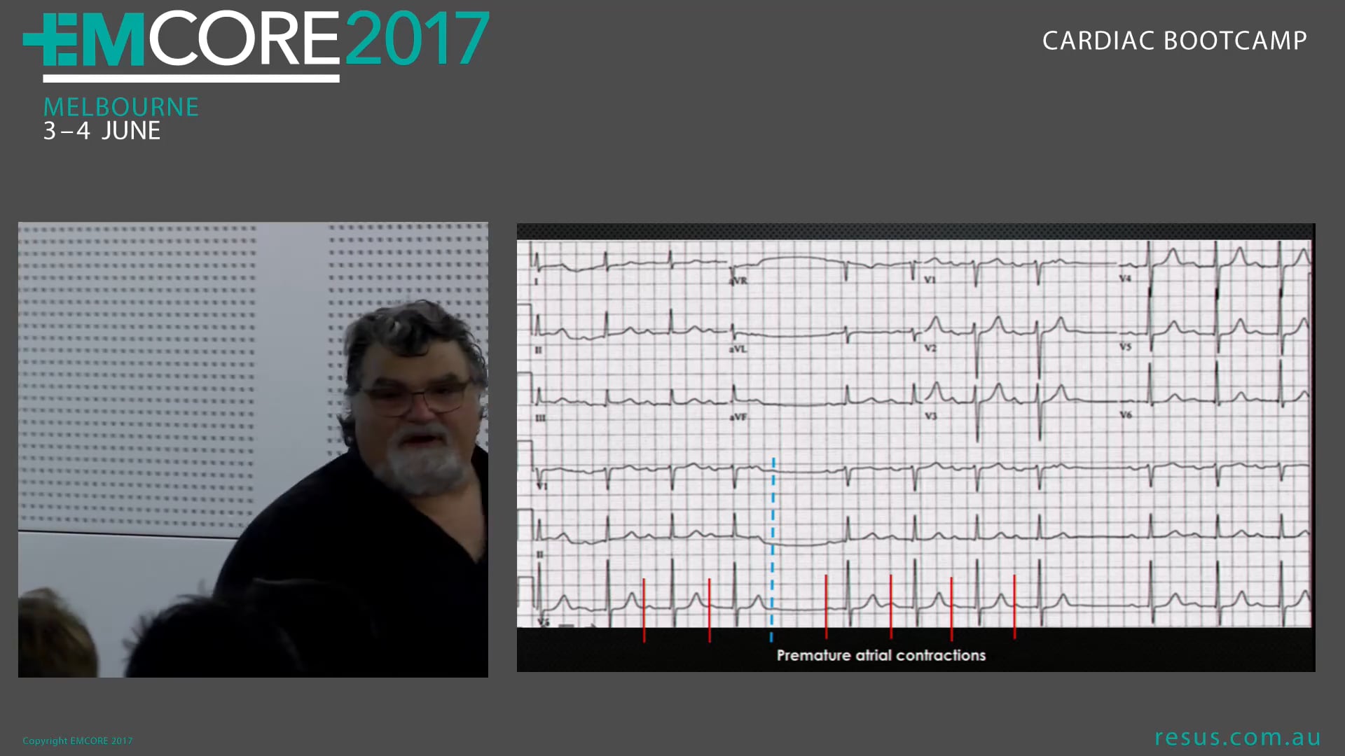 Mobitz Assoc Prof Peter Kas