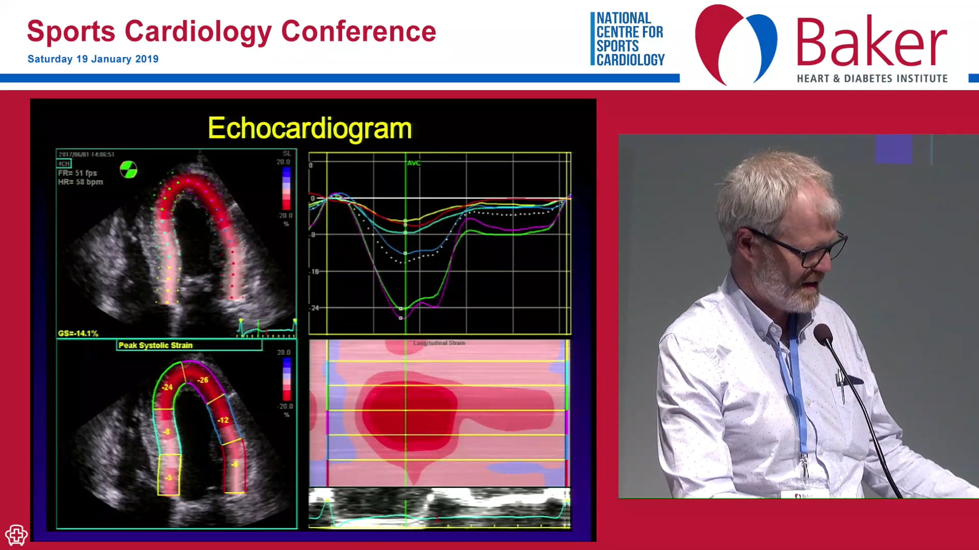 Imaging in the athlete what to do when the ECG is abnormal Assoc Prof David Prior
