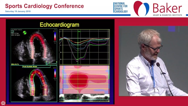 Imaging in the athlete what to do when the ECG is abnormal Assoc Prof David Prior