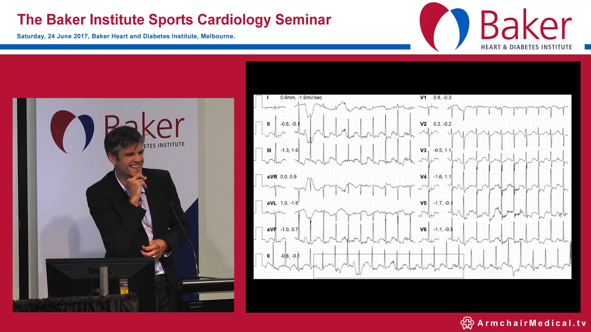 Case: Master athlete with cardiomyopathy Assoc Prof André La Gerche