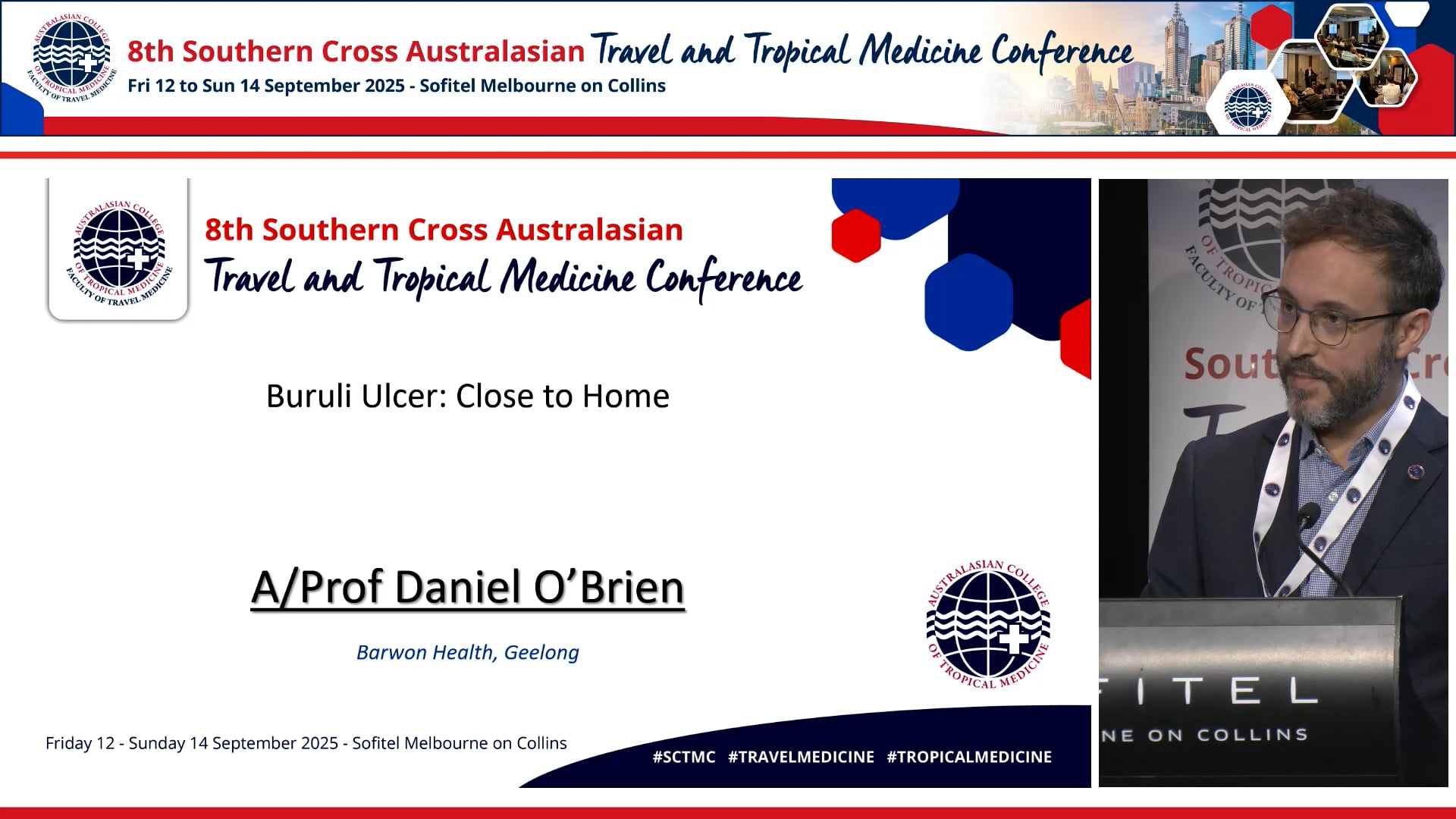 Buruli ulcer Close to home AProf Daniel O’Brien, Barwon Health, Victoria