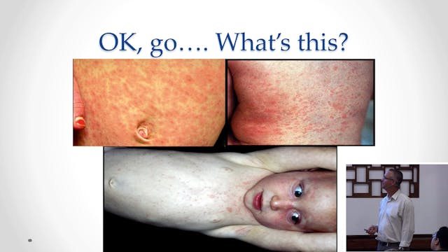 Rashes Quiz Dr Claire Wilkin-Marshall...