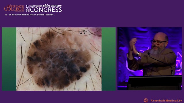 Last man standing Dermoscopy quiz presented by Dr Chris Wetherall