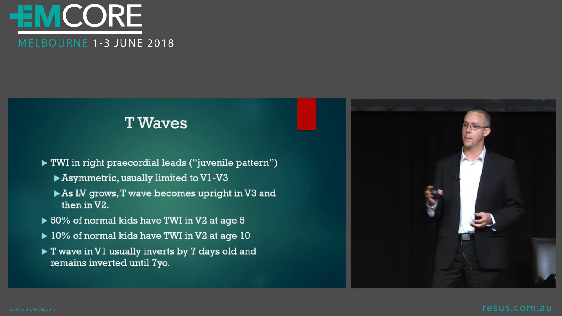 The Paediatric ECG Dr Adam Michael