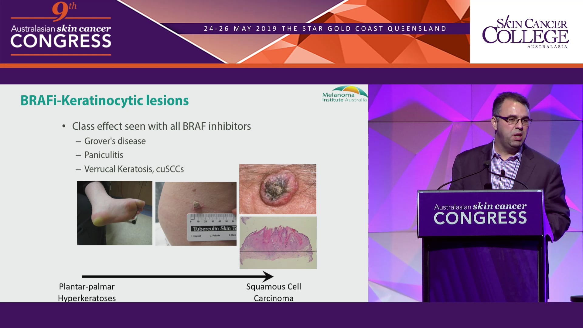 The evolving landscape of systemic therapy treated melanoma Assoc Prof Matteo Carlino