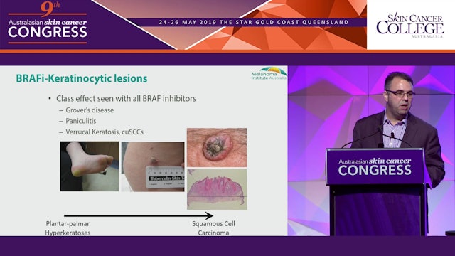 The evolving landscape of systemic therapy treated melanoma Assoc Prof Matteo Carlino