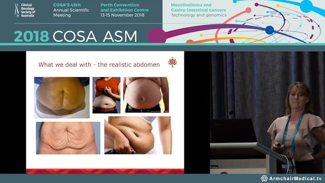 Stoma management, education and troub...