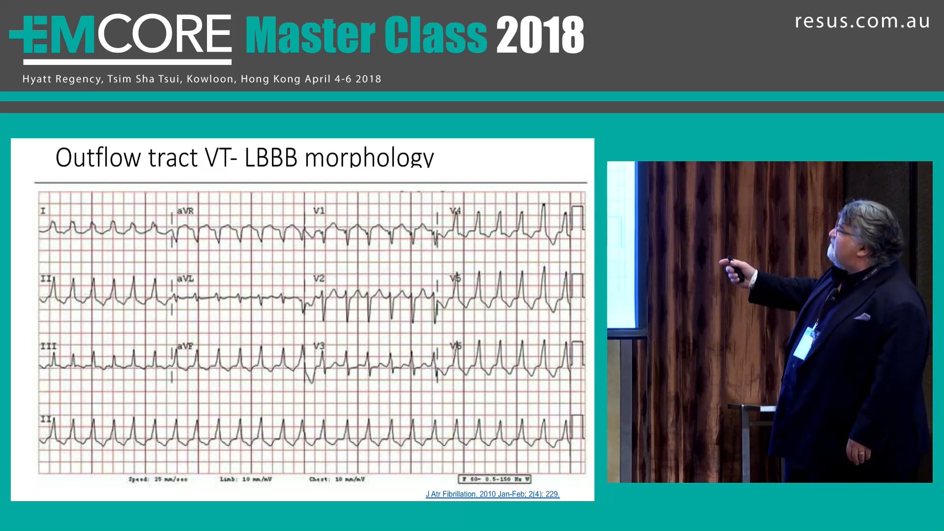 Arrhythmia A Case Assoc Prof Peter Kas