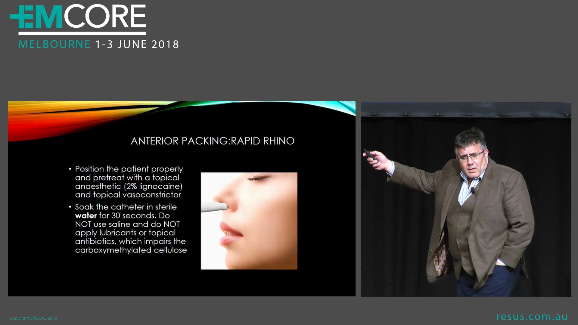 Epistaxis Dr Will Davies