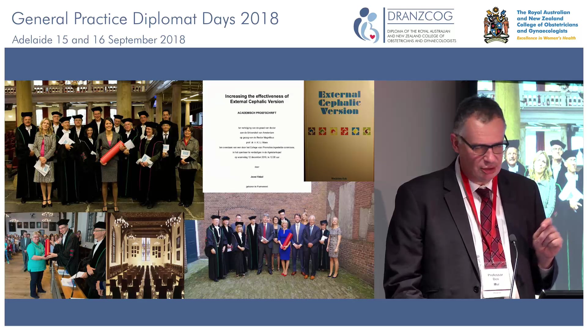 External cephalic version Prof Ben Mol