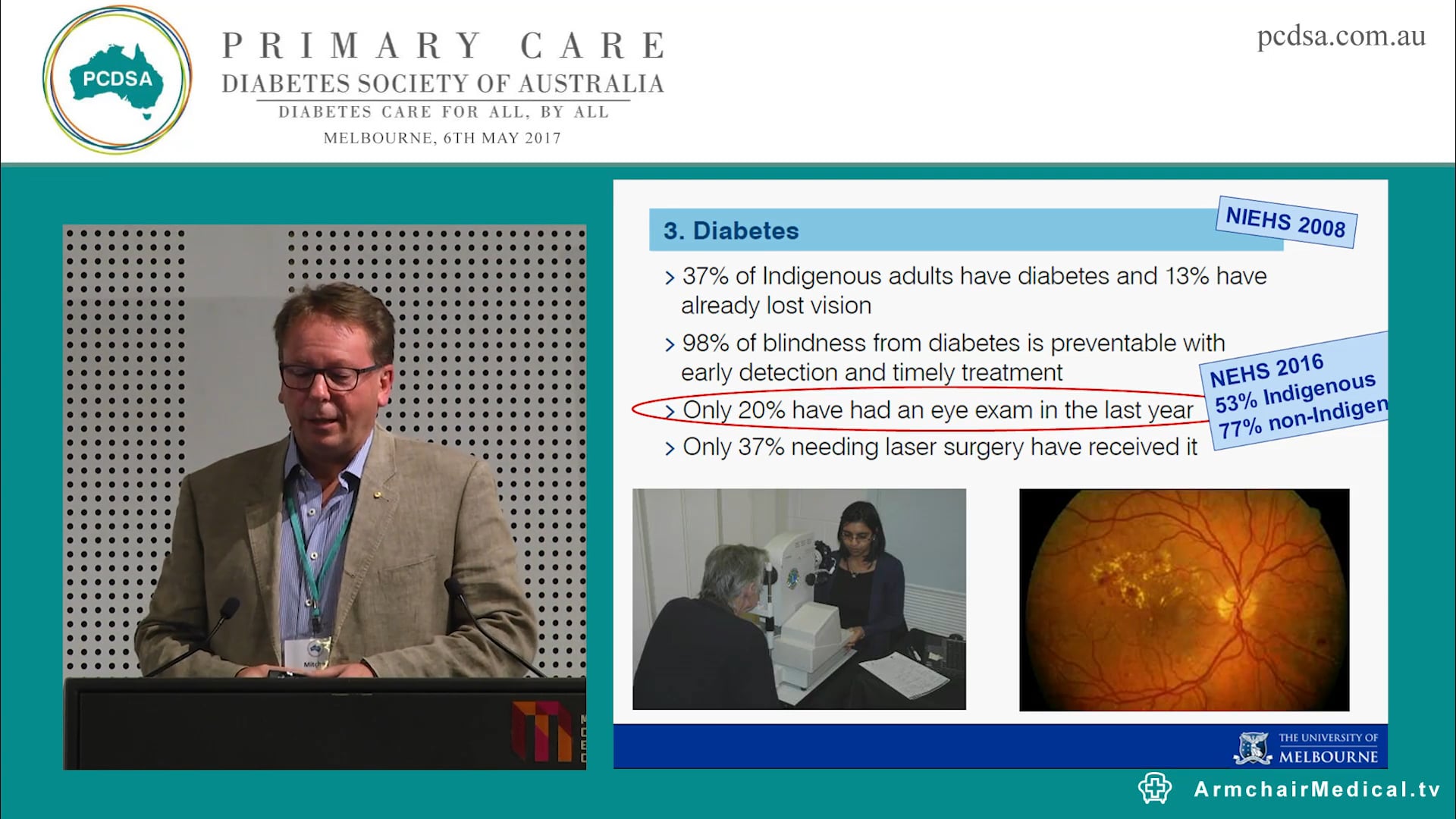 Why use optometry in this day and age when retinal cameras and item numbers are available? Mr Mitchell D Anjou AM