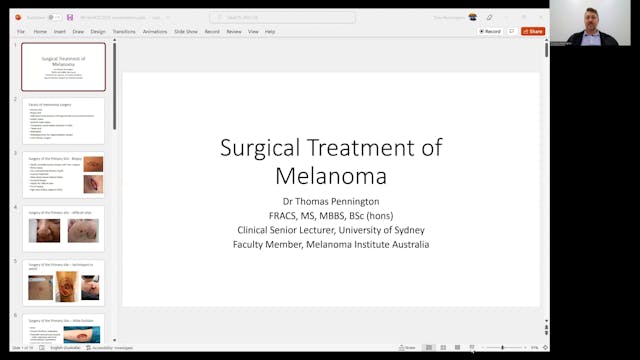 Surgical treatment for melanoma Dr Th...