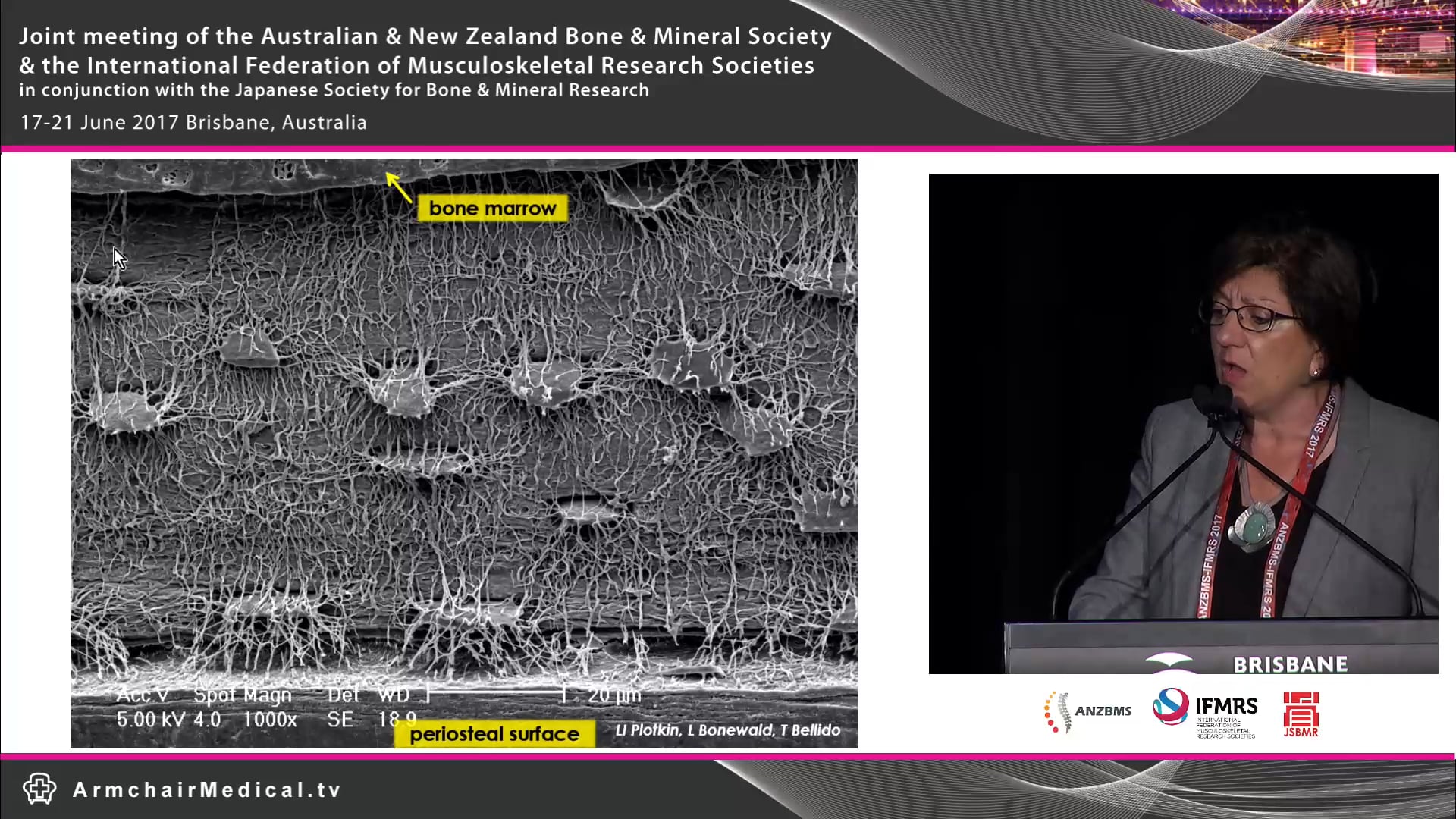 Osteocytes and mechanosensory pathway Prof Teresita Bellido