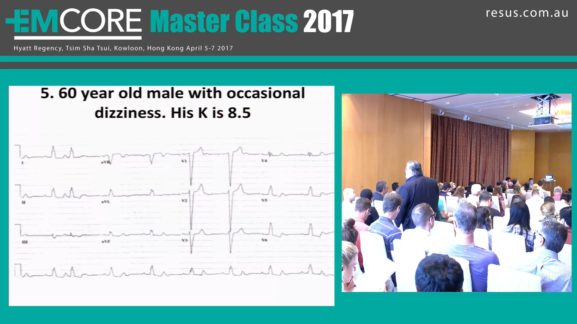 ECG Test Assoc Prof Peter Kas