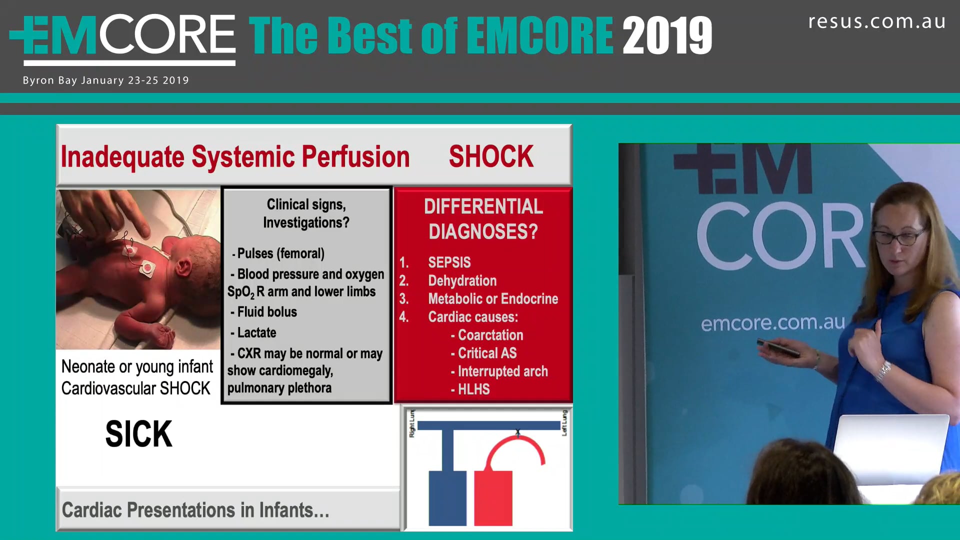 Paediatric Heart Conditions to know Claire Wilkin Marshall
