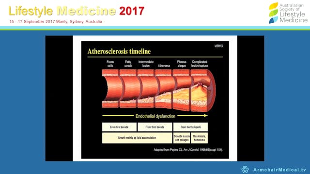 Lifestyle prevention of cardiovascula...