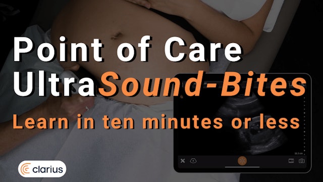 Ultrasound bites - Learn in ten minutes or less