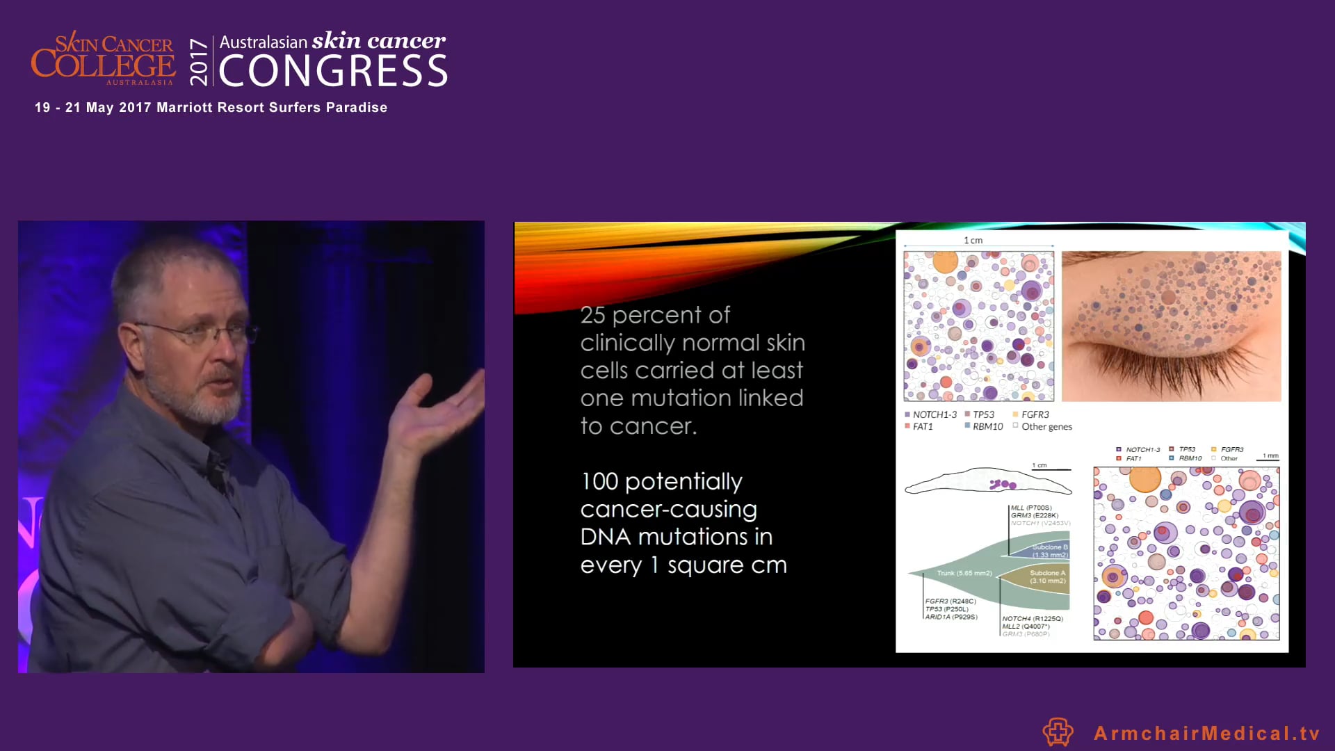 Daylight Photodynamic Treatment Dr Franz Strydom