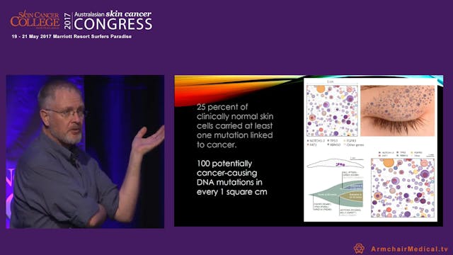 Daylight Photodynamic Treatment Dr Fr...