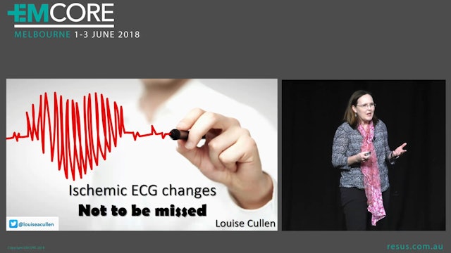 Ischaemic ECG Changes not to be missed Prof Louise Cullen