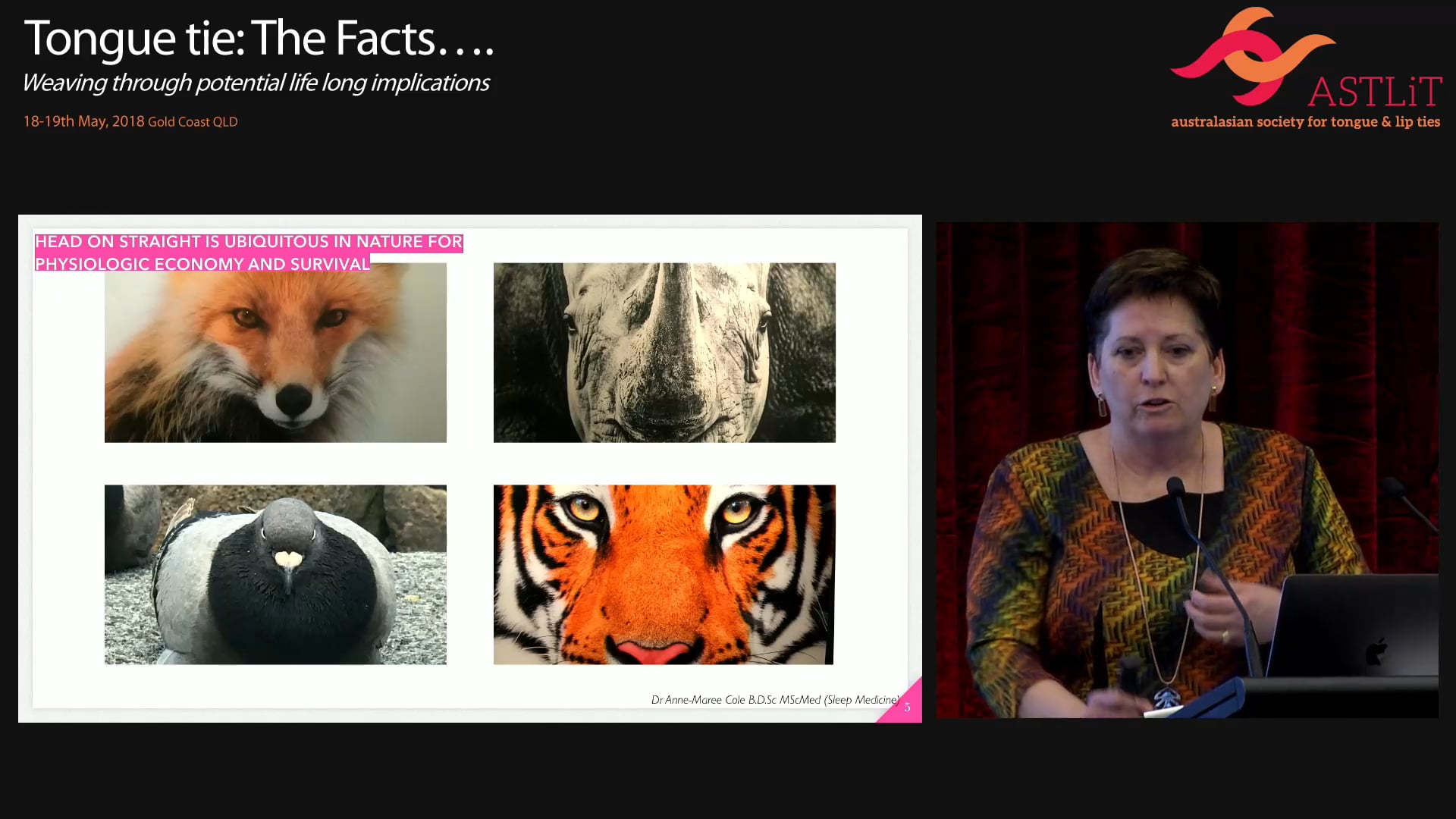 CBCT tour of tongue Anne-Maree Cole