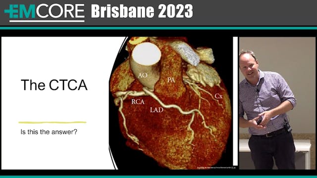 CT Coronary angiogram Graham Ireland