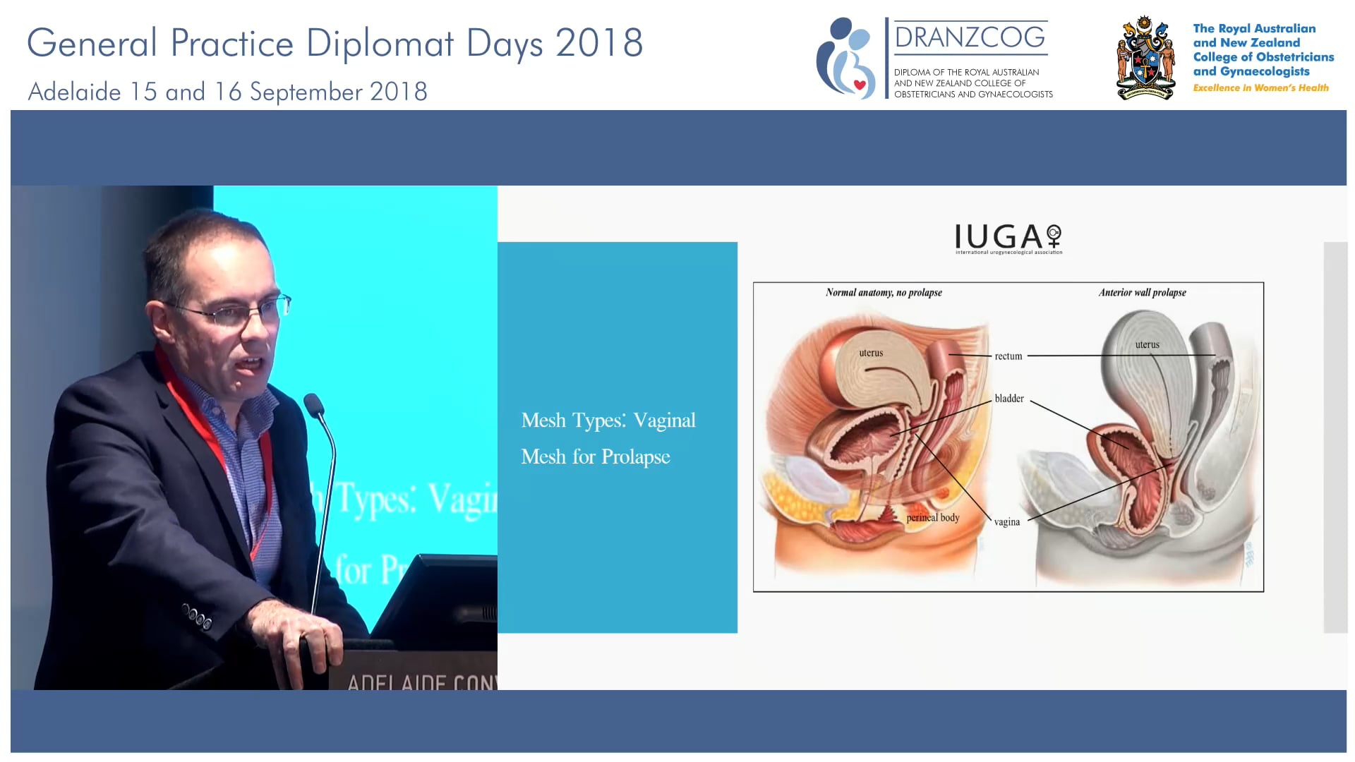 Caring for patients after Mesh surgery Dr David Munday