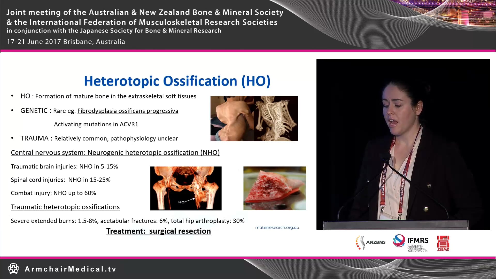 Proffered Papers - Basic Science 1