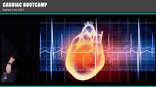 ECG of the Athlete A Prof Peter Kas