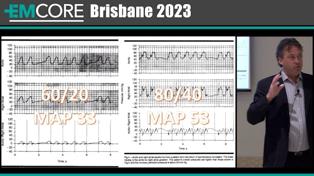 REBOA and Cardiac Arrest Assoc Prof L...