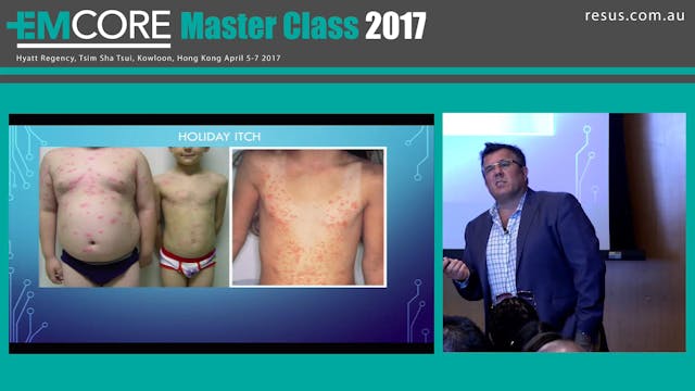 Rashes A quiz Dr Will Davies