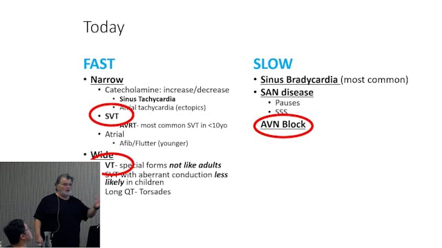 Arrhythmias in Kids Dr Peter Kas