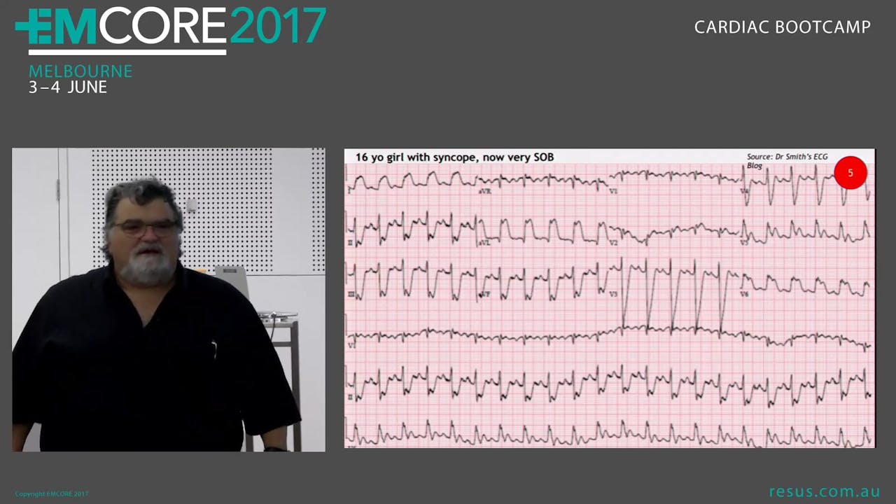 Paediatric ECG Assoc Prof Peter Kas - armchairmedical.tv