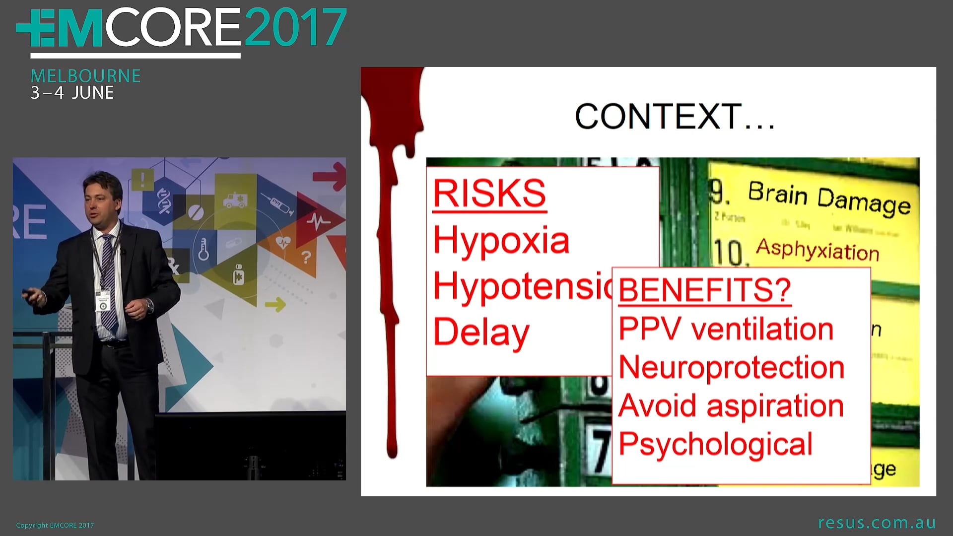The Trauma Airway Dr Luke Lawton Director Townsville ED